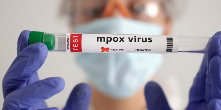 Fitch Ratings and mpox