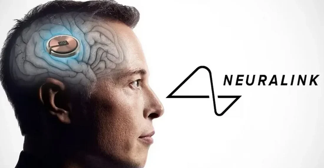 Elon Musk’s Neuralink