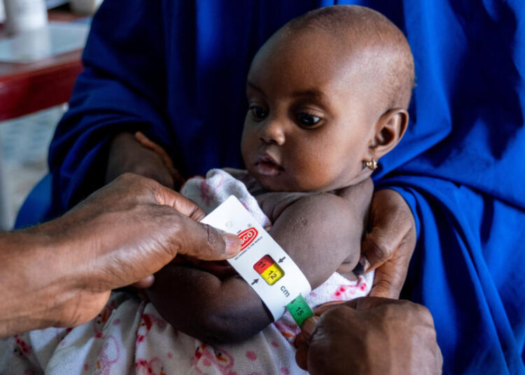 malnutrition in Nigeria