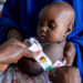 malnutrition in Nigeria