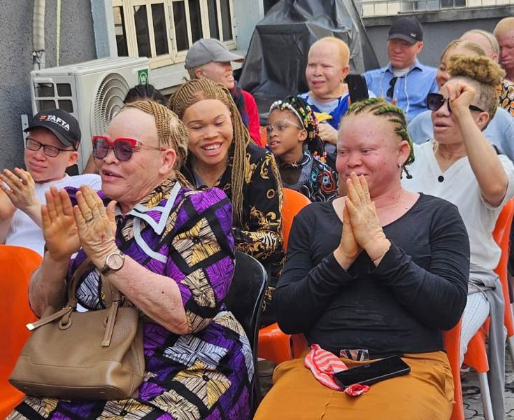 Nigerians Living With Albinism
