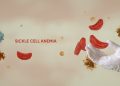 Nigeria Has World’s Highest Sickle Cell Burden with 1.5 Million Children