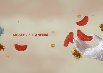Nigeria Has World’s Highest Sickle Cell Burden with 1.5 Million Children