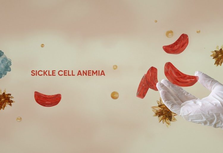 Nigeria Has World’s Highest Sickle Cell Burden with 1.5 Million Children