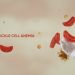 Nigeria Has World’s Highest Sickle Cell Burden with 1.5 Million Children